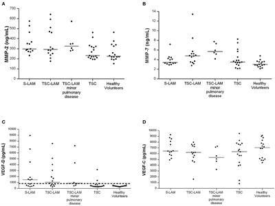 Exploring the Role of Matrix Metalloproteinases as Biomarkers in Sporadic Lymphangioleiomyomatosis and Tuberous Sclerosis Complex. A Pilot Study